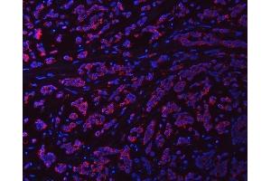 IF analysis of Syntaxin 18/STX18 using anti-Syntaxin 18/STX18 antibody (ABIN7599259).