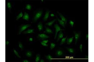 Image no. 2 for anti-Transcription Factor 19 (TCF19) (AA 17-103) antibody (ABIN598965) (TCF19 抗体  (AA 17-103))