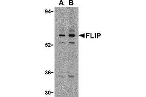 Western Blotting (WB) image for anti-CASP8 and FADD-Like Apoptosis Regulator (CFLAR) (N-Term) antibody (ABIN1031381) (FLIP 抗体  (N-Term))