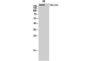 Western Blotting (WB) image for anti-Collagen, Type XI, alpha 1 (COL11A1) (Internal Region) antibody (ABIN3179970) (COL11A1 抗体  (Internal Region))