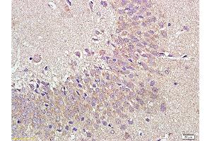 Formalin-fixed and paraffin embedded rat brain labeled with Anti-NPY1R Polyclonal Antibody, Unconjugated  at 1:400 followed by conjugation to the secondary antibody and DAB staining. (NPY1R 抗体  (AA 301-382))