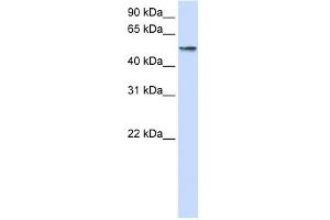 WB Suggested Anti-USP22 Antibody Titration: 0. (USP22 抗体  (Middle Region))