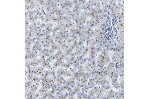 Immunohistochemical staining (Formalin-fixed paraffin-embedded sections) of human liver shows moderate membranous positivity in hepatocytes.