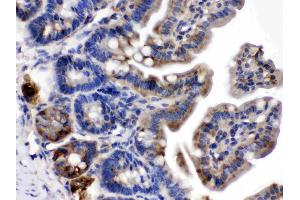 Talin 2 was detected in paraffin-embedded sections of mouse intestine tissues using rabbit anti- Talin 2 Antigen Affinity purified polyclonal antibody (Catalog # ) at 1 ? (TLN2 抗体  (Middle Region))