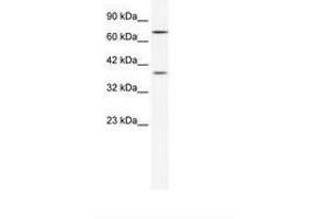 Image no. 1 for anti-Zinc Finger Protein 660 (ZNF660) (C-Term) antibody (ABIN202267) (ZNF660 抗体  (C-Term))