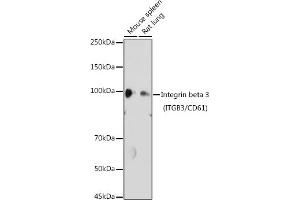 Western blot analysis of extracts of various cell lines, using Integrin beta 3 (ITGB3/CD61) antibody (ABIN6127572, ABIN6142584, ABIN6142586 and ABIN6219636) at 1:1000 dilution. (Integrin beta 3 抗体  (AA 610-718))