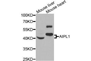 Western blot analysis of extracts of mouse liver and mouse heart cells, using AIPL1 antibody.