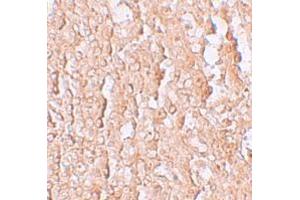 Immunohistochemistry (IHC) image for anti-Solute Carrier Family 39 (Zinc Transporter), Member 10 (SLC39A10) (Middle Region) antibody (ABIN1031176) (SLC39A10 抗体  (Middle Region))