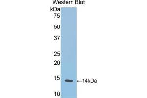 Detection of Recombinant HB, Cattle using Polyclonal Antibody to Hemoglobin (HB) (Hemoglobin 抗体)