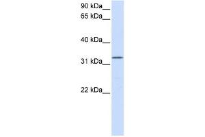 WB Suggested Anti-DOK5 Antibody Titration:  0. (DOK5 抗体  (N-Term))