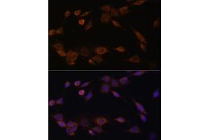 Immunofluorescence analysis of NIH-3T3 cells using CYPOR Polyclonal Antibody (ABIN6130227, ABIN6145969, ABIN6145970 and ABIN7101824) at dilution of 1:100 (40x lens). (POR 抗体  (AA 1-250))