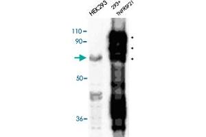 Immunodetection of transfected human TNFRSF21 in HEK 293 cells using TNFRSF21 polyclonal antibody . (TNFRSF21 抗体  (AA 372-665))