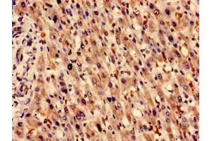 Immunocytochemistry (ICC) image for anti-Heme Oxygenase (Decycling) 1 (HMOX1) (AA 3-288) antibody (ABIN7154951)