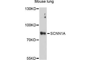 Western blot analysis of extracts of mouse lung, using SCNN1A antibody (ABIN5973225) at 1/1000 dilution. (SCNN1A 抗体)
