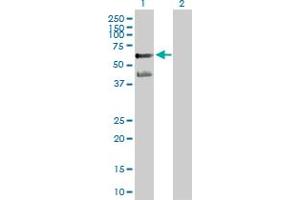 Western Blot analysis of PPARA expression in transfected 293T cell line by PPARA MaxPab polyclonal antibody. (PPARA 抗体  (AA 1-468))