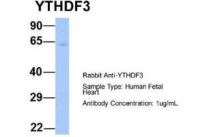Host: Rabbit  Target Name: YTHDF3  Sample Tissue: Human Fetal Heart  Antibody Dilution: 1. (YTHDF3 抗体  (N-Term))