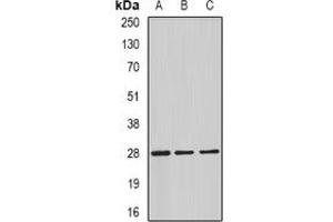 Western blot analysis of C4BP beta expression in HepG2 (A), mouse testis (B), rat testis (C) whole cell lysates. (C4BPB 抗体)