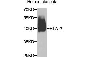 Western blot analysis of extracts of human placenta, using HLA-G antibody (ABIN5974455) at 1/1000 dilution. (HLAG 抗体)