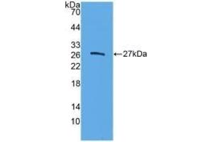 Detection of Recombinant ELA3B, Human using Polyclonal Antibody to Elastase 3B (ELA3B)