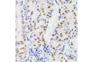 Immunohistochemistry of paraffin-embedded human stomach using XRCC5 Antibody.