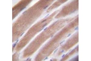 IHC testing of VEGFC antibody and FFPE human skeletal muscle. (VEGFC 抗体  (AA 20-49))