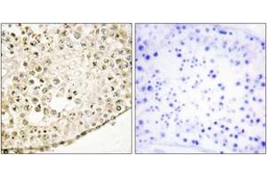 Immunohistochemistry analysis of paraffin-embedded human testis tissue, using SPZ1 Antibody. (SPZ1 抗体  (AA 111-160))