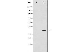 Western blot analysis of TNNI3 phosphorylation expression in Mouse hearttissue lysates,The lane on the left is treated with the antigen-specific peptide. (TNNI3 抗体  (pThr143))