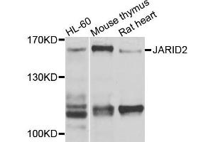 Western blot analysis of extracts of various cells, using JARID2 antibody. (JARID2 抗体)