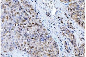 IHC analysis of FEN1 using anti-FEN1 antibody (ABIN7601619).