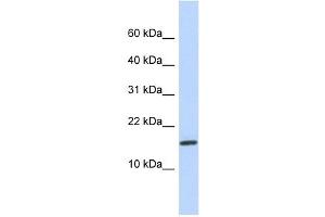 NCRNA00114 antibody used at 1 ug/ml to detect target protein. (NCRNA00114 抗体  (N-Term))