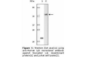Image no. 1 for anti-Lymphocyte-Specific Protein tyrosine Kinase (LCK) antibody (ABIN232106) (LCK 抗体)