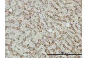 Immunoperoxidase of monoclonal antibody to TYR on formalin-fixed paraffin-embedded human liver tissue. (TYR 抗体  (AA 1-377))