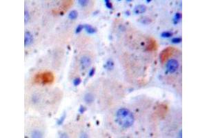 Used in DAB staining on fromalin fixed paraffin-embedded Liver tissue (FAS 抗体  (AA 188-319))