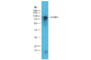 Lane 1: mouse heart lysates probed with Rabbit Anti-VCAM1 Polyclonal Antibody, Unconjugated  at 1:5000 for 90 min at 37˚C. (VCAM1 抗体  (AA 651-739))