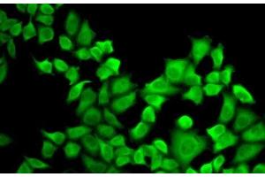 Immunofluorescence analysis of A-549 cells using DHFR Polyclonal Antibody (Dihydrofolate Reductase 抗体)