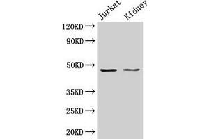 Western Blot Positive WB detected in: Jurkat whole cell lysate, Rat kidney tissue All lanes: ALDOA antibody at 3 μg/mL Secondary Goat polyclonal to rabbit IgG at 1/50000 dilution Predicted band size: 40, 46 kDa Observed band size: 46 kDa (ALDOA 抗体  (AA 2-364))