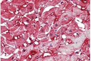 anti-Caspase 12 (Gene/pseudogene) (CASP12) antibody