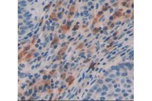 IHC-P analysis of Human Tissue, with DAB staining. (FBLN4 抗体  (AA 136-225))