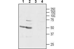 Western blot analysis of rat (lanes 1 and 3) and mouse (lanes 2 and 4) brain lysates: - 1,2. (GABRg1 抗体  (C-Term, Intracellular))