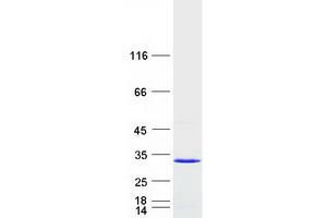 Validation with Western Blot (RAB14 Protein (Myc-DYKDDDDK Tag))