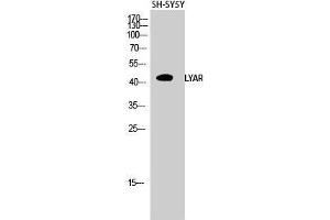 Western Blot (WB) analysis of SH-SY5Y cells using LYAR Polyclonal Antibody. (LYAR 抗体  (Internal Region))