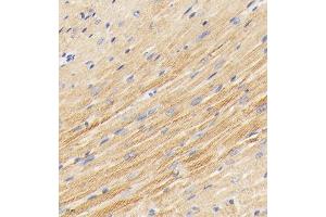 Immunohistochemistry analysis of paraffin embedded mouse heart using PDK3 (ABIN7075334) at dilution of 1: 2000 (PDK3 抗体)