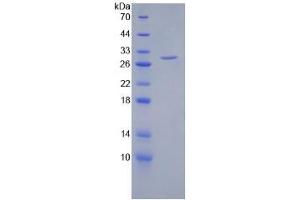 SDS-PAGE of Protein Standard from the Kit  (Highly purified E. (HSPG2 ELISA 试剂盒)