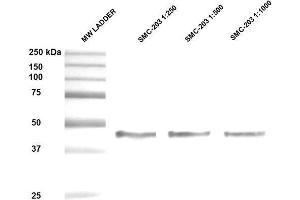 Western Blot analysis of Human Epithelial cell (A431) lysates showing detection of ~47 kDa Hsp47 protein using Mouse Anti-Hsp47 Monoclonal Antibody, Clone 1C4-1A6 . (SERPINH1 抗体)