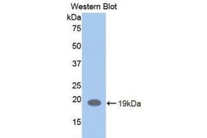 Western blot analysis of the recombinant protein. (LIFR 抗体  (AA 692-833))