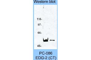 Image no. 1 for anti-Lysophosphatidic Acid Receptor 1 (LPAR1) (C-Term) antibody (ABIN187787) (LPAR1 抗体  (C-Term))