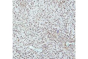 IHC analysis of PTBP2 using anti-PTBP2 antibody (ABIN7599452). (PTBP2 抗体  (AA 1-504))