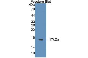Western Blotting (WB) image for anti-Solute Carrier Family 4, Anion Exchanger, Member 1 (erythrocyte Membrane Protein Band 3, Diego Blood Group) (SLC4A1) (AA 558-675) antibody (ABIN5013133)