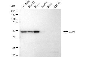 Western blotting analysis using CLP1 antibody (ABIN7798094). (Recombinant CLP1 抗体)