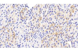Immunohistochemistry (IHC) image for anti-Phospholipase C, delta 4 (PLCD4) (AA 1-250) antibody (ABIN7445174)
